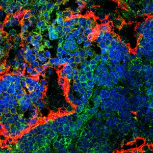 Lymphatic vessels and T cells within lymph nodes